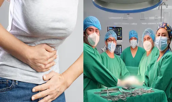Mujer que sufría fuertes dolores en el abdomen tenía tumor de 8 kilos