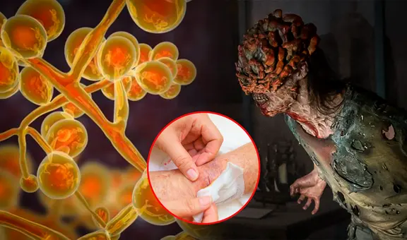 "The last of us": el hongo Cordyceps no es capaz de crear una epidemia, pero existe uno que sí