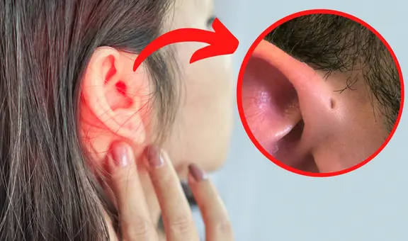 ¿Por qué algunas personas tienen un orificio en la oreja y otras no?