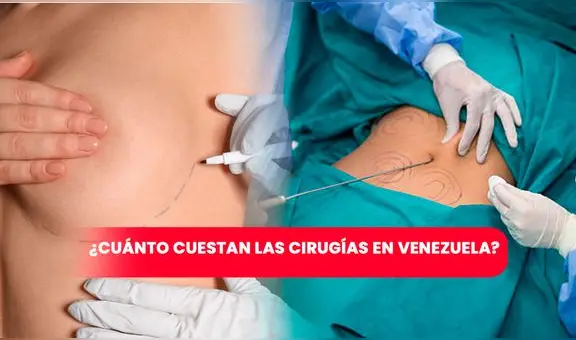 Aumento de senos, lipoescultura y otras cirugías plásticas: ¿cuánto cuestan en Venezuela?