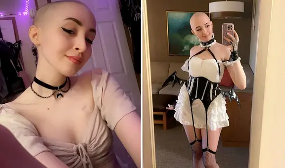 OnlyFans: joven usa ganancias para tratarse contra el cáncer y dice que sus fans "aman su look calvo"