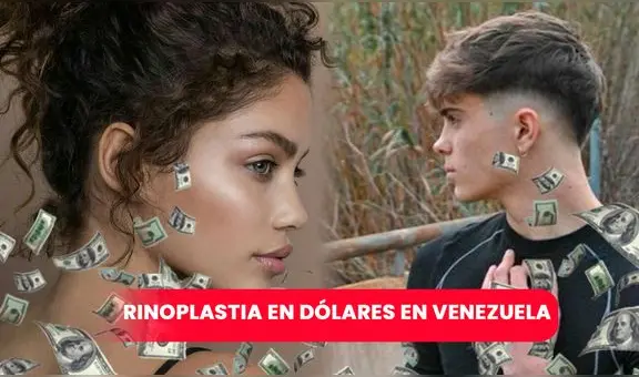 Rinoplastia en Venezuela: ¿cuánto cuesta una cirugía de nariz?