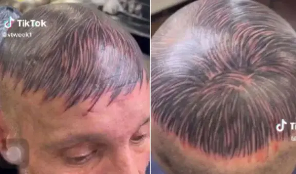 Hombre se tatúa la cabeza para disimular su calvicie y usuarios lo trolean: “Ya no se despeina”