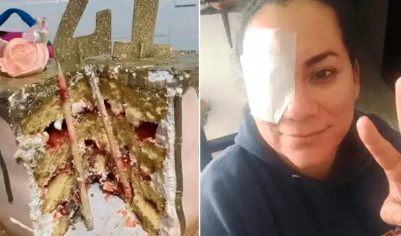 ¡Por poco se queda ciega! Hunden el rostro de mujer en pastel y termina con palo incrustado en el ojo