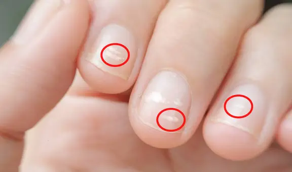 ¿Alguna vez te salieron manchas blancas en las uñas? Conoce cuál es su origen y cómo eliminarlas