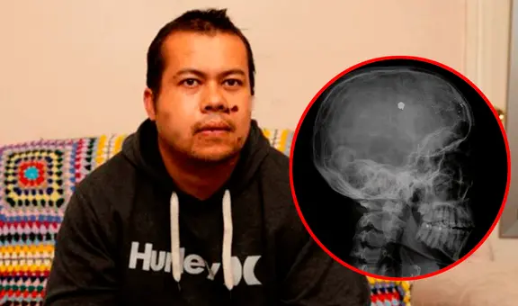 James Myers, el australiano que vive con 3 balas en la cabeza tras recibir 13 disparos en una casa