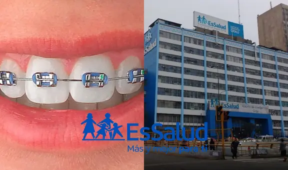 ¿Puedo ponerme brackets con el seguro de EsSalud?