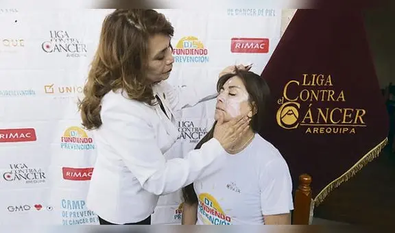 Casos de cáncer a la piel incrementan en 14% en Arequipa, advierten especialistas