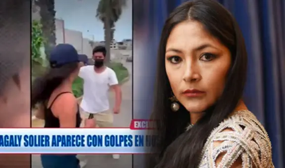 Magaly Solier preocupa a fans tras ser captada en hospital con moretón en el rostro
