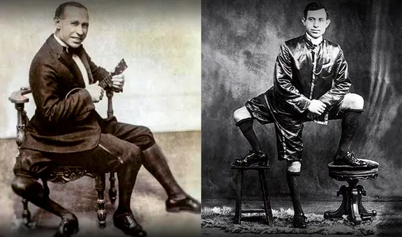Frank Lentini, el 'maraviglioso': la estrella de circo con 16 dedos, 4 pies, 3 piernas y 2 penes