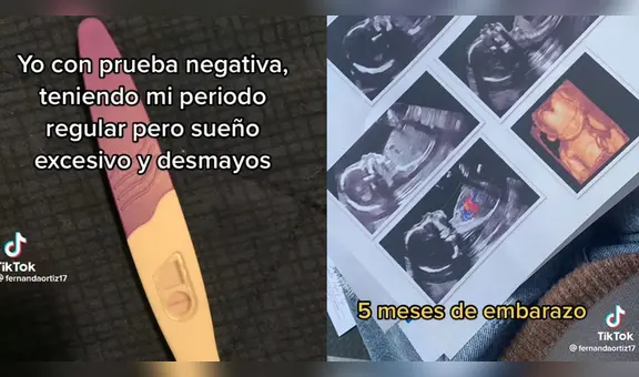 Joven pensó que sufría anemia, fue al doctor y se enteró de que tiene 5 meses de embarazo