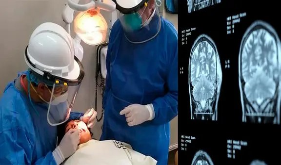 ¿Por qué cepillarse los dientes podría ser clave para prevenir el alzhéimer?