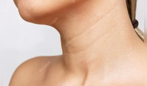 ¿Por qué aparecen líneas en el cuello y cómo atenuarlas?