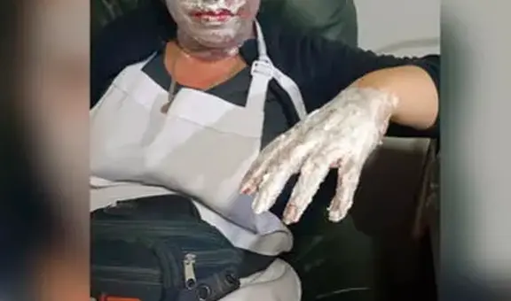 Surquillo: ciudadana extranjera sufre quemaduras tras intentar que no decomisen su puesto de empanadas