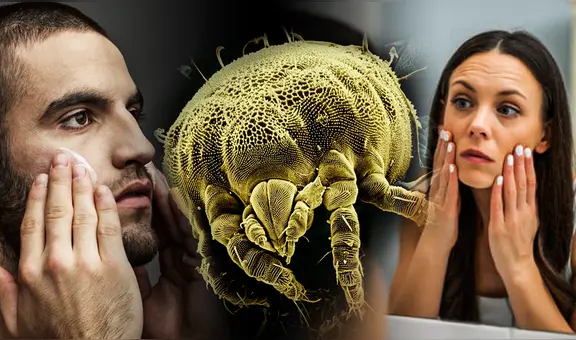 ¿Cómo son los ácaros que viven en nuestra cara? Ahí comen y se reproducen