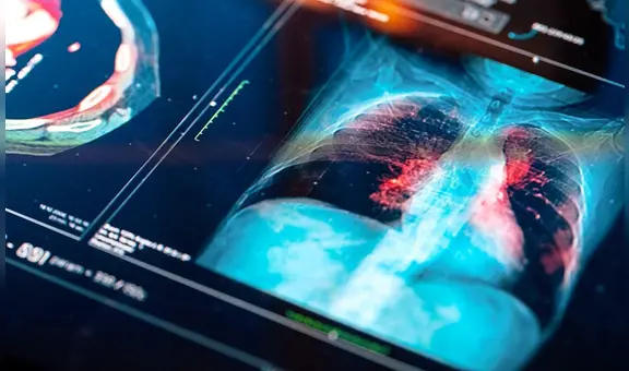 Crean tecnología que podría detectar cáncer en menos de 3 horas