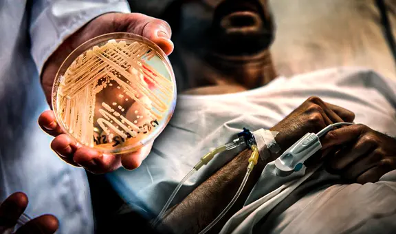 Candida auris: ¿por qué es considerado como "amenaza urgente" en Estados Unidos?