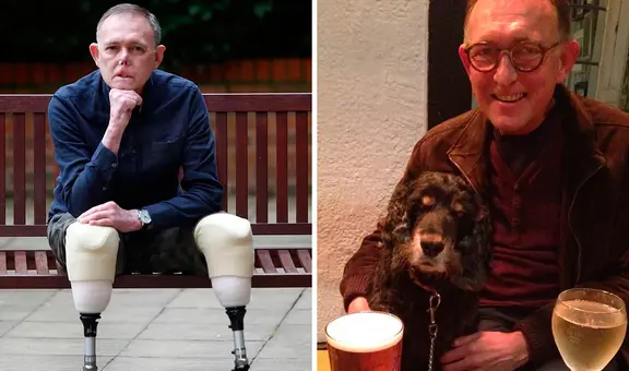 El terrible caso de Jaco: ¿cómo un arañazo de su perro le hizo perder sus piernas y parte de su cara?