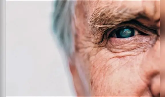 Oftalmología: Cuidado con la catarata, afecta tu visión