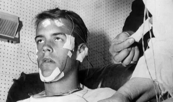 Los terribles efectos en el joven que pasó más de 11 días sin dormir por un experimento