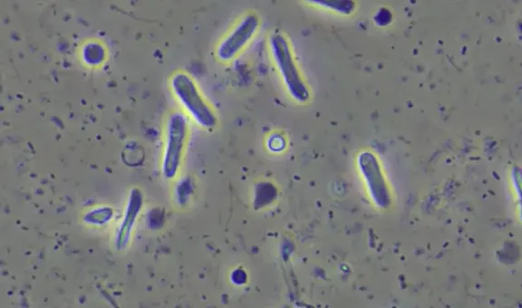 Nubes transportan bacterias resistentes a los antibióticos, según estudio