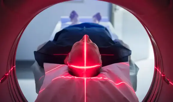 Escáner cerebral con inteligencia artificial consigue leer los pensamientos y traducirlos a palabras