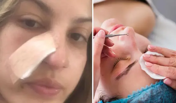 Joven se realiza una limpieza facial y descubre que tiene cáncer: "Mi mundo se derrumbó"