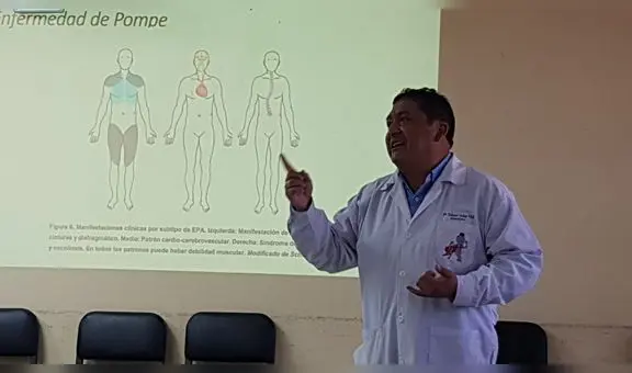 Anuncian campaña para detectar el mal de Pompe en Cusco: ¿de qué trata esta enfermedad?