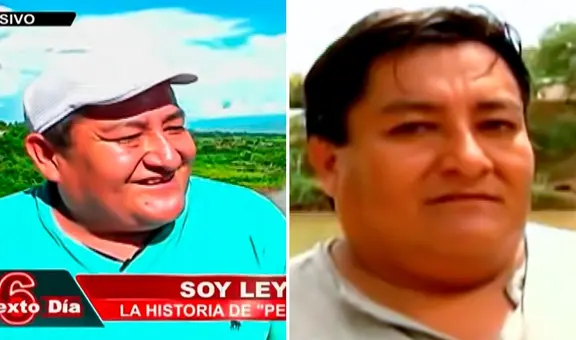 'Pepito Dos Cañones': la impactante historia del único hombre peruano que nació con 2 penes