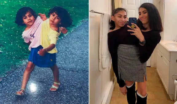 Así viven las hermanas siamesas que comparten pelvis y son sensación en TikTok