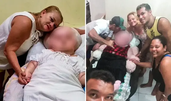 Gaziely Alves: la joven brasileña con hidrocefalia gigante que lleva 29 años luchando por su vida