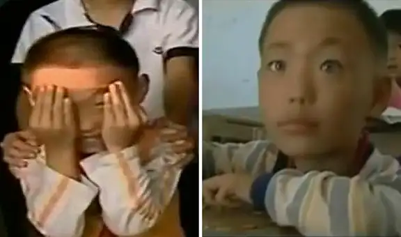Nong Youhui, el caso del ‘Niño gato’ que emite un brillo azul de sus ojos: lee en la oscuridad