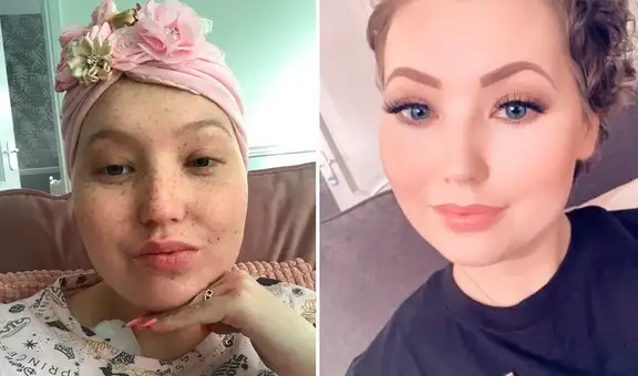 Joven británica pensó que le dolía el pecho por estrés y descubrió que tenía cáncer