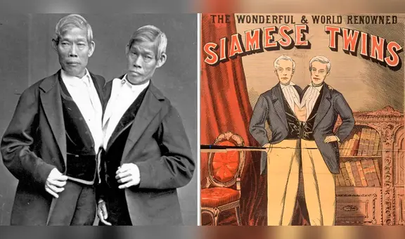 Chang y Eng Bunker, los siameses vendidos como esclavos que se volvieron ricos traficando personas