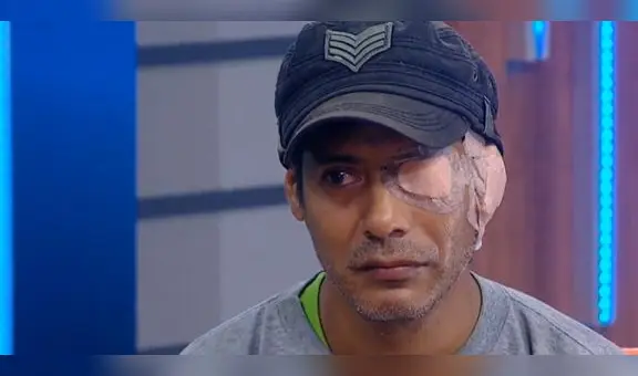 Comas: joven que perdió ojo el año pasado denuncia que empresa aún no se hace responsable