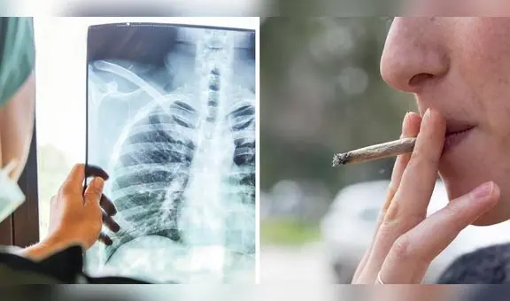 Mujer es diagnosticada de cáncer de pulmón terminal a pesar de que nunca fumó: ¿a qué se debe?