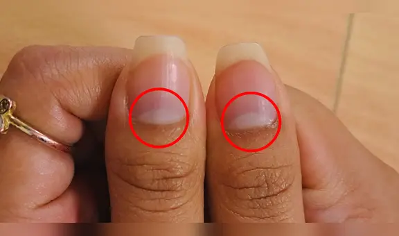 ¿Qué es la lúnula de las uñas y por qué no todos lo tienen?