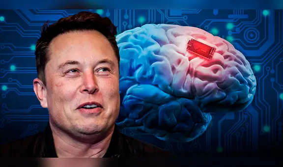 Neuralink de Elon Musk obtiene permiso para implantar chips en cerebros de humanos en EE. UU.