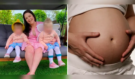 Una mujer quedó embarazada 2 veces en 28 días y dio a luz a los bebés en la misma fecha