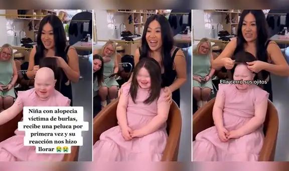 Niña que sufre de alopecia se pone peluca por primera vez y su reacción se vuelve viral: “Me hizo llorar”