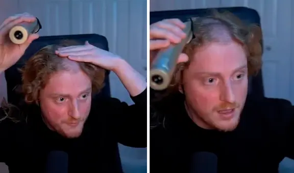 Hombre descubre abolladura en su cabeza por uso excesivo de auriculares al raparse en vivo