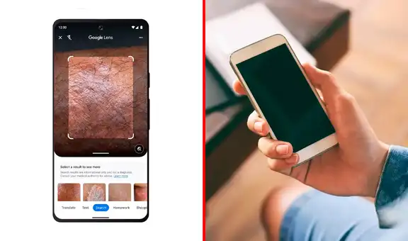 Google Lens podría ayudarte a detectar enfermedades en tu piel con la cámara de tu teléfono