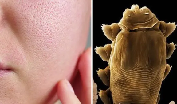 Estos ácaros tienen ‘sexo’ en nuestra cara: ¿por qué deberíamos estar felices con su presencia?