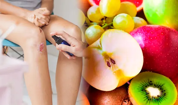 Cura heridas, previene la caída del cabello y fortalece los dientes: ¿qué VITAMINA es?