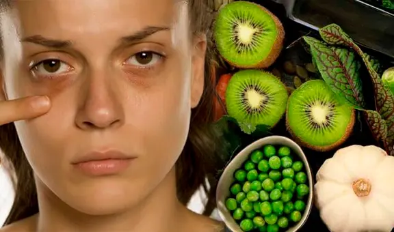 ¡Dile adiós a las ojeras! Esta es la VITAMINA que debes tomar para eliminarlas para siempre