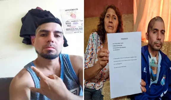 Joven sufrió derrame cerebral tras ser víctima de pepeo en Los Olivos