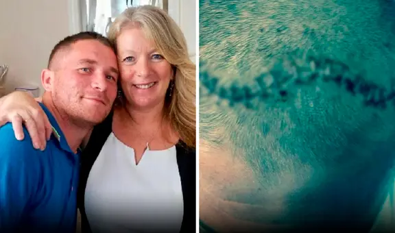 Hombre que se sentía repentinamente “excitado y agresivo” es diagnosticado de cáncer cerebral