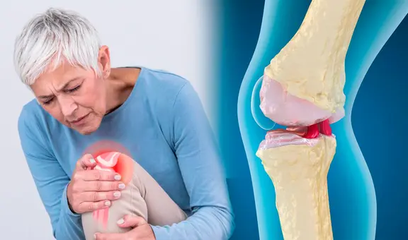 La clave para regenerar el colágeno de tus rodillas y fortalecer tus articulaciones