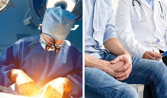 Para los hombres responsables: campaña de vasectomía se realizará GRATIS en Arequipa