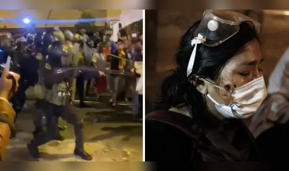 PNP reconoce que dispararon contra manifestantes, pero aseguran que no fueron perdigones